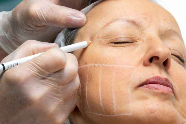 CryoPen: 5 Skin Concerns It May Be Used to Treat 4 What should you ask before having CryoPen treatment Hampshire?