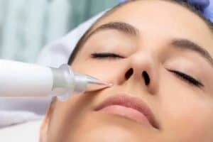 Best Actinic Keratoses Removal 3 Actinic keratoses Hampshire solutions - book in today!